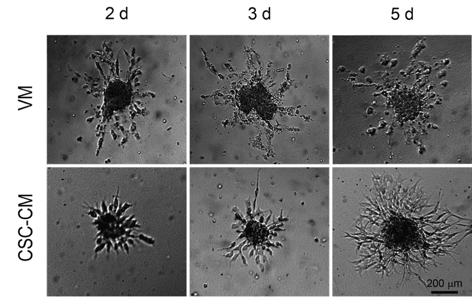 Angiogenesis image 1